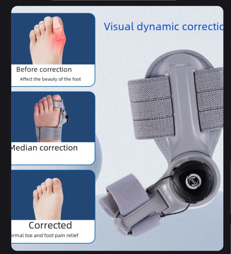 Upgraded Adjustable Bunion Corrector